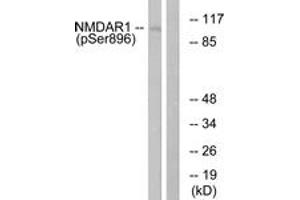 Western blot analysis of extracts from K562 cells treated with PMA 125ng/ml 30', using NMDAR1 (Phospho-Ser896) Antibody. (GRIN1/NMDAR1 抗体  (pSer897))