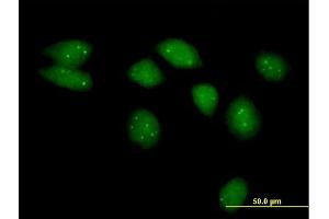 Immunofluorescence of purified MaxPab antibody to NSMCE2 on HeLa cell. (NSMCE2 抗体  (AA 1-247))