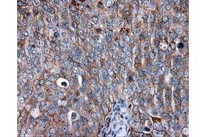 Immunohistochemical staining of paraffin-embedded liver tissue using anti-CD36 mouse monoclonal antibody. (CD36 抗体)