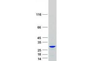 Western Blotting (WB) image for Chromobox Homolog 1 (CBX1) (Transcript Variant 1) protein (Myc-DYKDDDDK Tag) (ABIN2713259)