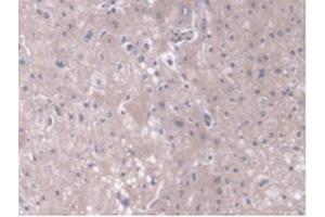IHC-P analysis of Human Liver Tissue, with DAB staining. (TOM70 抗体  (AA 333-608))