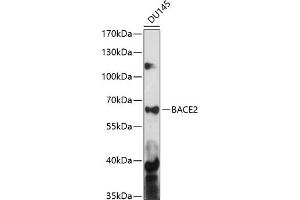 Western blot analysis of extracts of DU145 cells, using B antibody (ABIN7265880) at 1:1000 dilution. (BACE2 抗体  (AA 240-470))