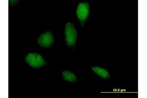 Immunofluorescence of purified MaxPab antibody to RECQL5 on HeLa cell. (RECQL5 抗体  (AA 1-435))