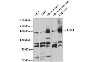 Western blot analysis of extracts of various cell lines, using  antibody (ABIN1678678, ABIN3017841, ABIN3017842 and ABIN6220287) at 1:1000 dilution.