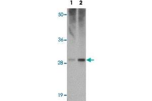 Western blot analysis of HVCN1 in human spleen tissue lysate with HVCN1 polyclonal antibody  at (1) 0. (HVCN1 抗体  (C-Term))