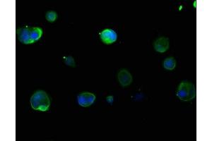 Immunofluorescence (IF) image for anti-Keratin 16 (KRT16) (AA 265-333) antibody (ABIN7157388)