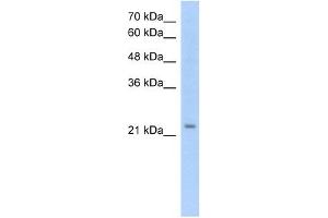 EMP2 antibody used at 1. (EMP2 抗体  (Middle Region))