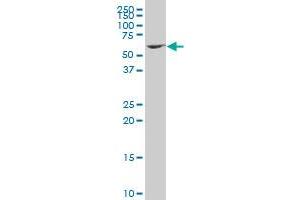 ZNF37A polyclonal antibody (A01), Lot # 051005JC01 Western Blot analysis of ZNF37A expression in MES-SA/Dx5 . (ZNF37A 抗体  (AA 121-230))