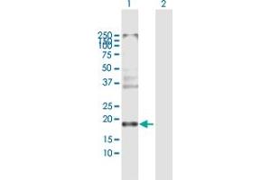 Western Blot analysis of CLDN8 expression in transfected 293T cell line by CLDN8 MaxPab polyclonal antibody. (CLDN8 抗体  (AA 1-225))