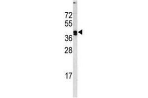 Western blot analysis of LOX antibody and MDA-MB468 lysate (LOX 抗体  (AA 234-260))