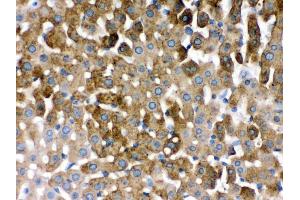 Immunohistochemistry (Paraffin-embedded Sections) (IHC (p)) image for anti-Sulfotransferase Family, Cytosolic, 2A, Dehydroepiandrosterone (DHEA)-Preferring, Member 1 (SULT2A1) (AA 253-285), (C-Term) antibody (ABIN3043941) (SULT2A1 抗体  (C-Term))