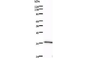 Western Blotting (WB) image for anti-LIM Domain Only 1 (Rhombotin 1) (LMO1) antibody (ABIN932474) (LMO1 抗体)
