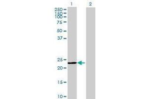 Lane 1: MEI1 transfected lysate ( 25. (MEI1 293T Cell Transient Overexpression Lysate(Denatured))