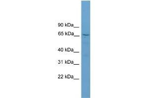 WB Suggested Anti-SCG2 Antibody Titration:  0. (SCG2 抗体  (N-Term))