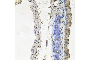 Immunohistochemistry of paraffin-embedded mouse lung using NDUFA6 antibody at dilution of 1:100 (x40 lens).