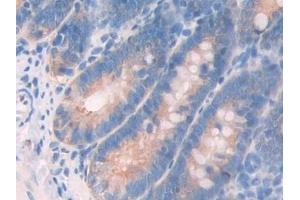 Immunohistochemistry (IHC) image for anti-Myosin, Light Chain 6B, Alkali, Smooth Muscle and Non-Muscle (MYL6B) (AA 6-137) antibody (ABIN7439591)