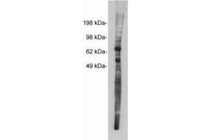 Image no. 1 for anti-Netrin 1 (NTN1) antibody (ABIN201815) (Netrin 1 抗体)
