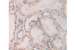 IHC-P analysis of Human Tissue, with DAB staining. (FGF13 抗体  (AA 63-245))