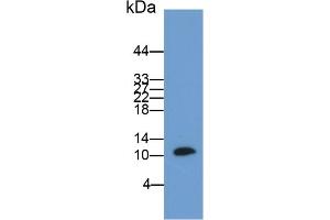 Detection of S100B in Rat Cerebrum lysate using Polyclonal Antibody to S100 Calcium Binding Protein B (S100B) (S100B 抗体  (AA 1-92))