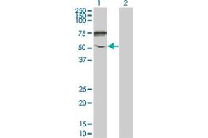 Western Blot analysis of ENPP5 expression in transfected 293T cell line by ENPP5 monoclonal antibody (M01), clone 1C5-1D7. (ENPP5 抗体  (AA 24-477))