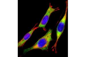 Immunofluorescence (IF) image for anti-Ras-Related C3 Botulinum Toxin Substrate 2 (Rho Family, Small GTP Binding Protein Rac2) (RAC2) (AA 178-192), (C-Term) antibody (ABIN6243370)