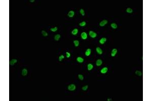 Immunofluorescence staining of Hela cells with ABIN7127720 at 1:100,counter-stained with DAPI. (Recombinant NRF2 抗体  (pSer40))