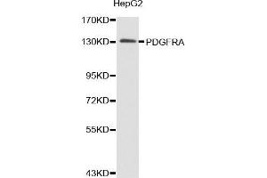 Western blot analysis of extracts of HepG2 cell lines, using PDGFRA antibody. (PDGFRA 抗体  (AA 1-210))