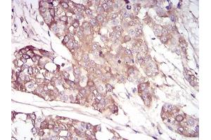 Immunohistochemistry (IHC) image for anti-serpin Peptidase Inhibitor, Clade A (Alpha-1 Antiproteinase, Antitrypsin), Member 3 (SERPINA3) (AA 279-432) antibody (ABIN5684069)