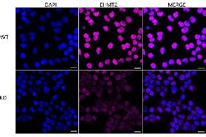 Immunocytochemical staining of HeLa cells using EHMT2 antibody (ABIN7797609), 1:1,000), Top panel: wild-type (WT), Bottom panal: EHMT2 shRNA knockdown (KD). (Recombinant EHMT2 抗体)