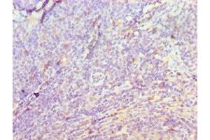 Immunohistochemistry of paraffin-embedded human tonsil tissue using ABIN7149566 at dilution of 1:100 (DIDO1 抗体  (AA 1-300))