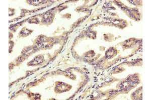 Immunohistochemistry (IHC) image for anti-Sterol Regulatory Element Binding Transcription Factor 1 (SREBF1) (AA 38-201) antibody (ABIN7170778)