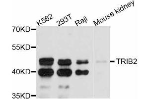 Western blot analysis of extracts of various cell lines, using TRIB2 antibody (ABIN5999100) at 1:3000 dilution. (TRIB2 抗体)