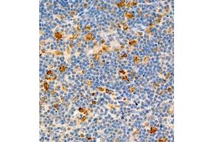 Immunohistochemistry of paraffin embedded rat thymus using MHC-II (ABIN7074245) at dilution of 1:1800 (400x lens) (CD74 抗体)