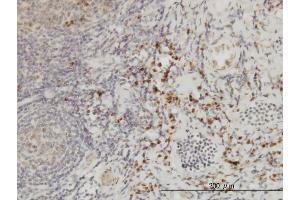 Immunoperoxidase of monoclonal antibody to CSE1L on formalin-fixed paraffin-embedded human tonsil. (Exportin 2 抗体  (AA 872-971))