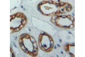 Used in DAB staining on fromalin fixed paraffin-embedded Kidney tissue (IKbIP 抗体  (AA 132-314))