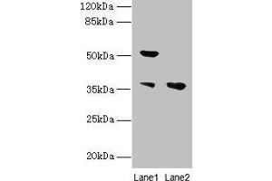 Western blot All lanes: IMPACT antibody at 10 μg/mL Lane 1: Hela whole cell lysate Lane 2: HL60 whole cell lysate Secondary Goat polyclonal to rabbit IgG at 1/10000 dilution Predicted band size: 37, 23 kDa Observed band size: 37, 52 kDa (IMPACT 抗体  (AA 41-320))