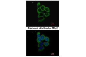 ICC/IF Image Immunofluorescence analysis of methanol-fixed A431, using PSMD2, antibody at 1:500 dilution.
