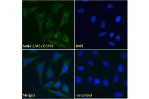 IF/ICC testing of fixed and permeabilized human HeLa cells with GRP78 antibody (green) at 5ug/ml and DAPI nuclear stain (blue). (GRP78 抗体)