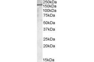 ABIN190772 (1µg/ml) staining of Human Kisney lysate (35µg protein in RIPA buffer). (PODXL 抗体  (C-Term))