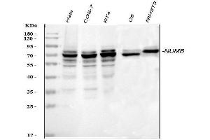 Western blot analysis of NUMB using anti-NUMB antibody (ABIN3043374).