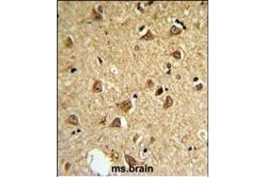 Immunohistochemistry (Paraffin-embedded Sections) (IHC (p)) image for anti-Deiodinase, Iodothyronine, Type II (DIO2) (AA 165-191) antibody (ABIN652664)
