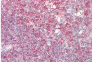 Human Tonsil: Formalin-Fixed, Paraffin-Embedded (FFPE)