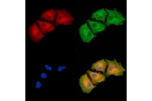 ABIN6260907 and ABIN6279340 staining  cells by IF/ICC. (CNDP2 抗体  (C-Term))