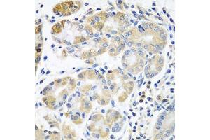 Immunohistochemistry of paraffin-embedded human stomach using PLS3 antibody. (Plastin 3 抗体  (AA 1-240))