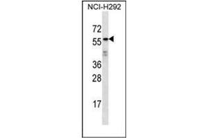 Western blot analysis of ODF2L Antibody (C-term) in NCI-H292 cell line lysates (35ug/lane). (ODF2L 抗体  (C-Term))
