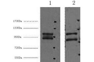 Western Blot analysis of 1) Hela, 2) HepG2 cells using IDE Monoclonal Antibody at dilution of 1:2000. (IDE 抗体)