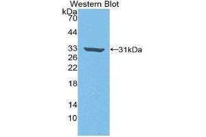 Western Blotting (WB) image for anti-rho-Associated, Coiled-Coil Containing Protein Kinase 2 (ROCK2) (AA 904-1140) antibody (ABIN3205961) (ROCK2 抗体  (AA 904-1140))