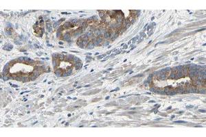 ABIN6275121 at 1/100 staining Human prostate tissue by IHC-P. (EIF3F 抗体  (Internal Region))