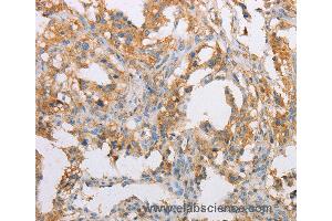 Immunohistochemistry of Human brain  using ACTR2 Polyclonal Antibody at dilution of 1:40 (ACTR2 抗体)