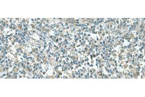 Immunohistochemistry of paraffin-embedded Human tonsil tissue using CCT5 Polyclonal Antibody at dilution of 1:55(x200) (CCT5 抗体)